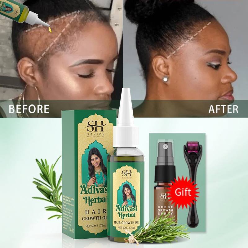 Ajurwedyjski olejek na porost  – Hair Care Essence Oil Spray recenzja i cena