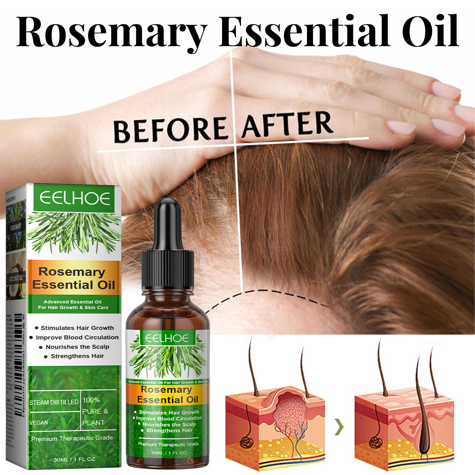 Serum na porost włosów Szybko  – Hair Care Essence Oil Spray recenzja i cena
