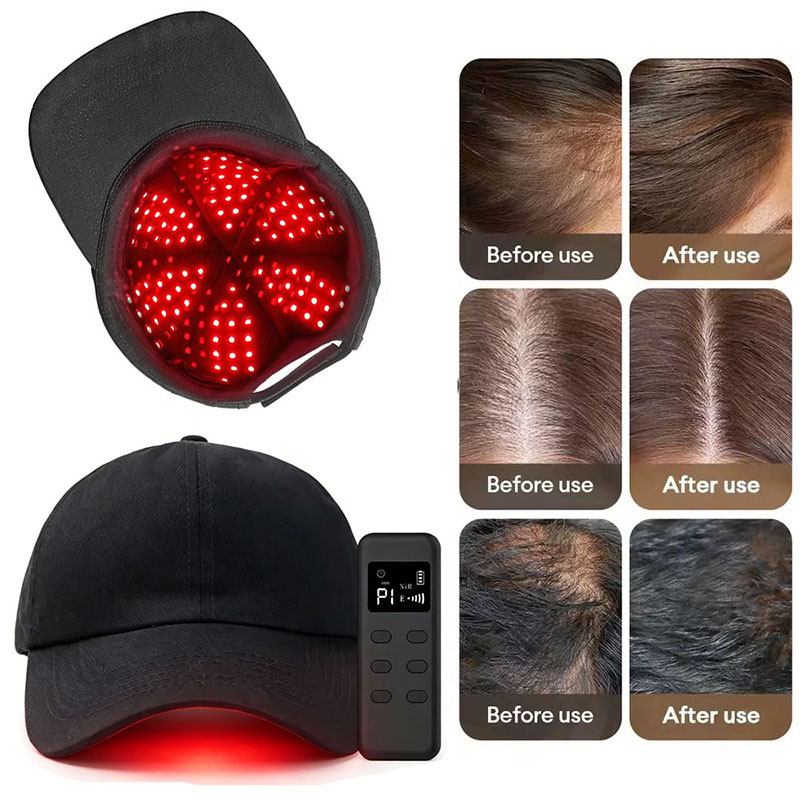Czapka do terapii światłem LED – Hair Care Wella recenzja i cena