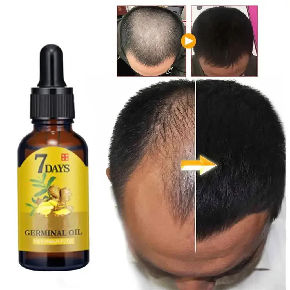 Wzrost włosów Imbir Szybko ros – Hair Care Essence Oil Spray recenzja i cena